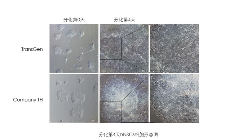 喜訊：全式金獲一項發(fā)明專(zhuān)利授權--“一種用于人神經(jīng)系統細胞培養和人多能性干細胞向神經(jīng)系統細胞分化的營(yíng)養添加劑”
